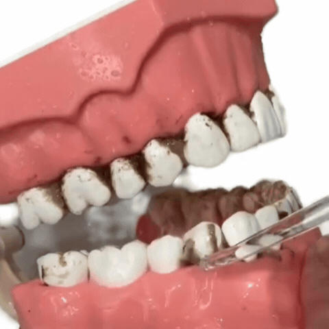 Irrigador Dental Portátil