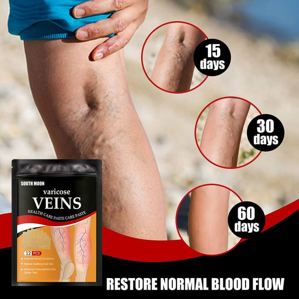 Parches Mágicos para Varices