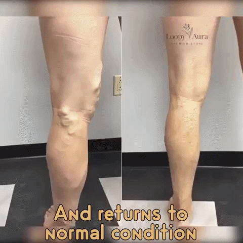 Parches Mágicos para Varices
